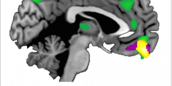 Brain Structure Varies With Trust Level