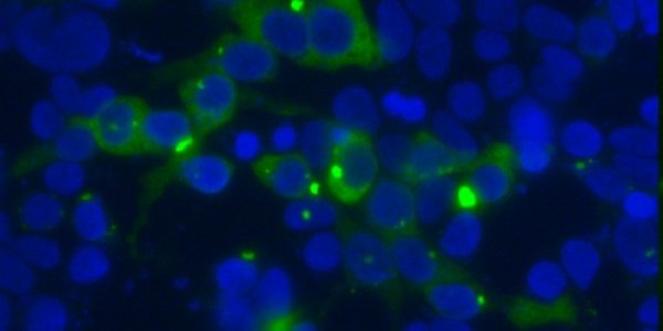 Understanding The 'Sickness' Bug