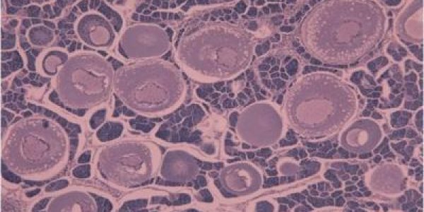 'Gender-Bending' Chemicals Like Estrogen In Rivers Are Impacting Reproduction