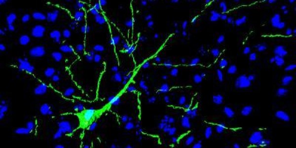 Implanted Neurons Made From Adult Stem Cells Become Part Of The Brain