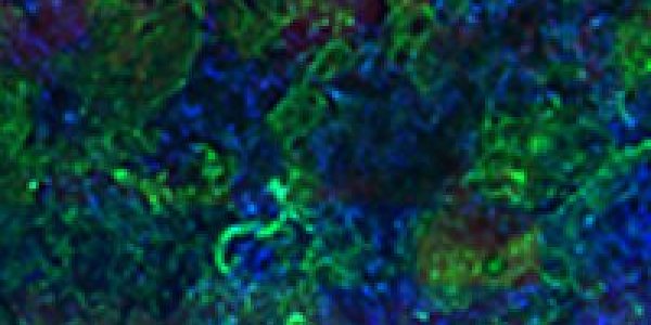 Engineers Design Artificial Bones That Naturally 'Blend' Into Tendons