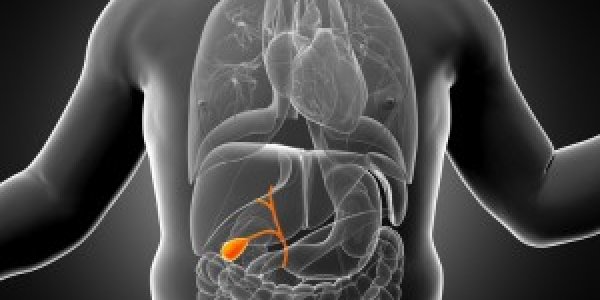 Laparoscopic Gallbladde Removal Is Safe For Kids