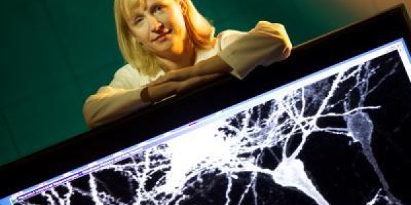 Matrix Metalloproteinase 9 Enzyme Linked To Autistic Behavior