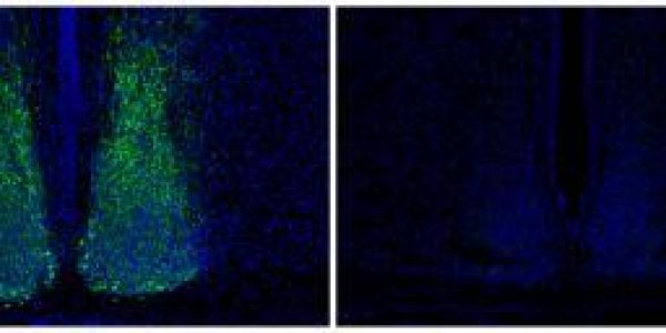 Lhx1 Is The Gene For Jet Lag