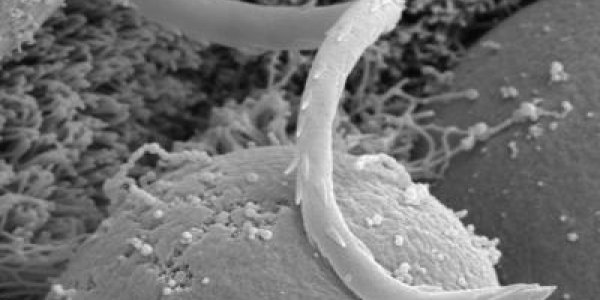 Lethal Parasite Evolved From Pond Scum