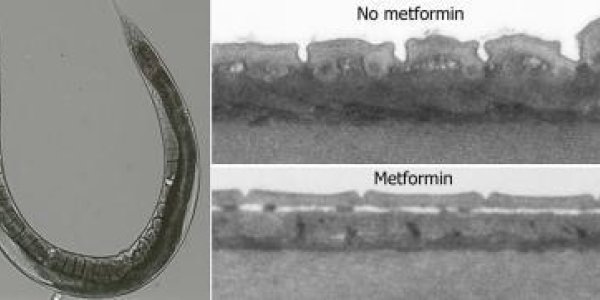 Diabetes Drug Metformin Slows Aging, Says PNAS Study