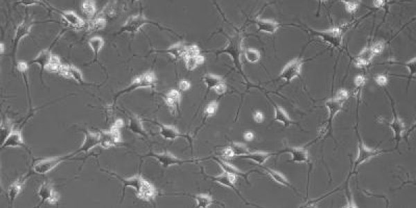 Stem Cells From Teeth Resemble Brain Cells