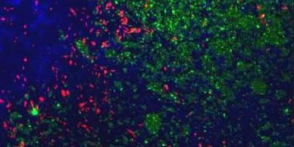 Cell Cultures In 3D Show Nanoparticle Drug Delivery Results