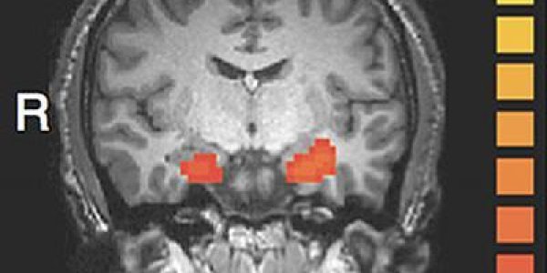 Gruseome Details Versus Evidence - The Brain Science Of Punishment Decisions