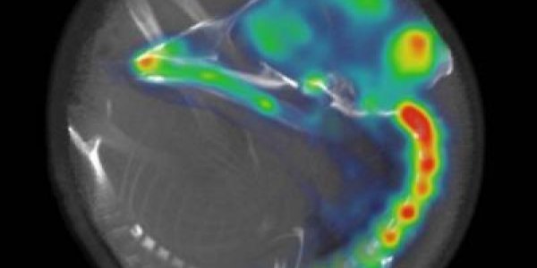 Embryo Brains Can Wake Earlier Than Previously Thought