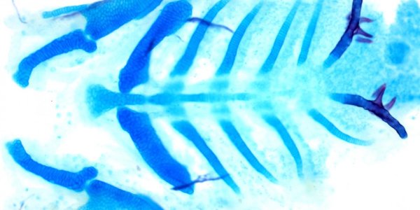 How Gene Expression Affects The Facial Kind