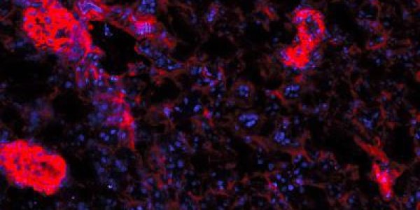 B-cells Aggravate Autoimmune Diseases