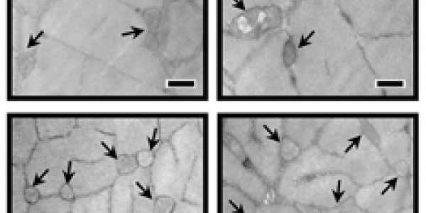 Synthetic Oil Triheptanoin Improves Autism Spectrum Disorder And Longevity