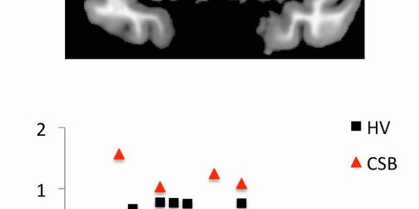 Is Sex Addiction Real?