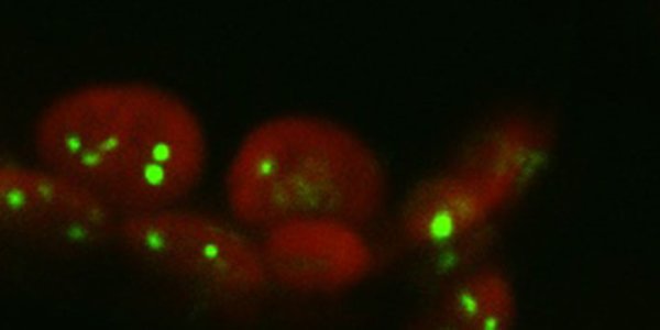 Can Synthetic Biology Improve Photosynthesis?