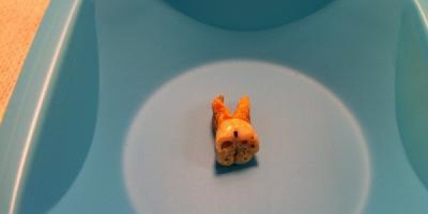 Could The Black Death Plague Be In Our Future Again?