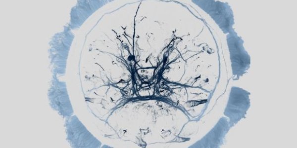 Sleep Hormone In Humans Makes Plankton Jet Lagged Too