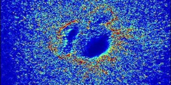 Baby Hearts Need Rhythm To Develop Correctly