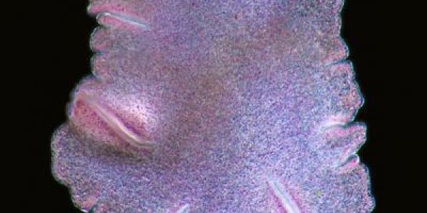 Trichoplax Adhaerens Genome Shows Simplest Animal Has Complex Metabolic Capabilities