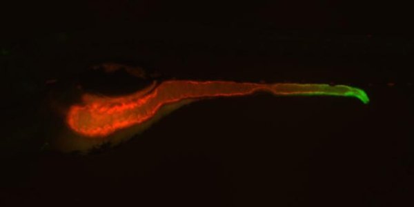 Molecular Trigger Of Inflammatory Bowel Disease Discovered