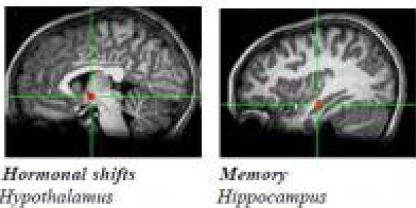 Oh No You Didn't - Teen Girls Emotion Circuits Spark More Than Boys