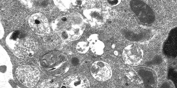 M6P Deficiency Leaves B Cells Out Of Sorts