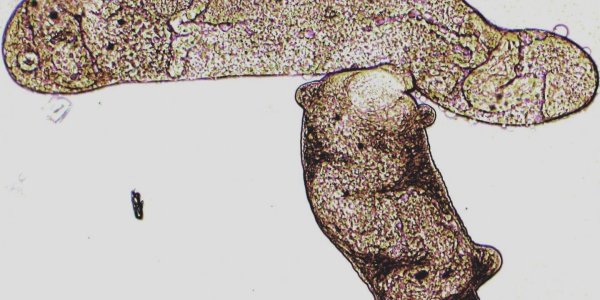 Parasitic Flatworms Flout Global Biodiversity Patterns