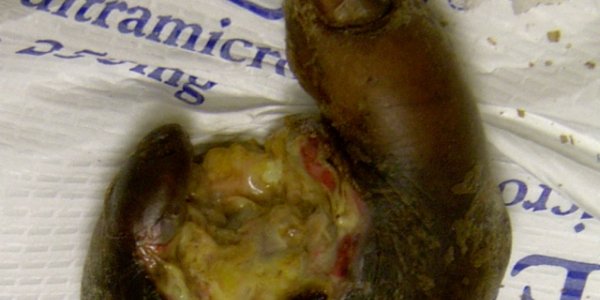 How long you can sleep on your arm without losing it...