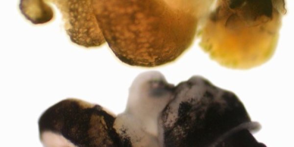 Geographic Mosaic Theory And How Parasites Make Sex Worthwhile