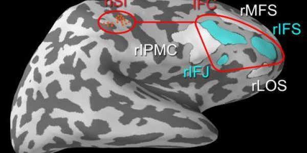 How The Brain Ignores Distractions