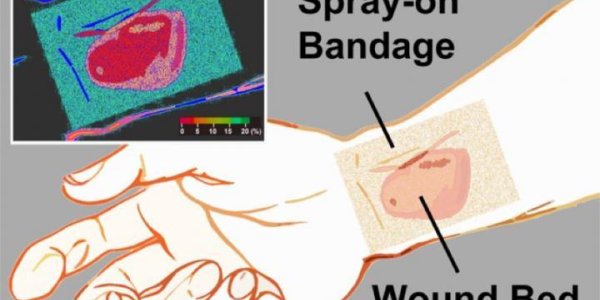 A Status Bar For Wounds: 'Smart' Bandage Emits Phosphorescent Glow For Healing