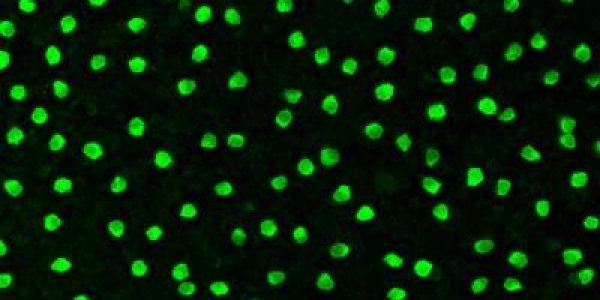 Cholinergic Amacrine: Heritable Nerve Cell Creates A 'Personal' Space