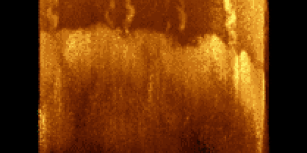 Sensors In Your Skin?