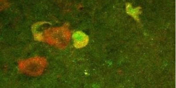 P45 And P75: New Clues To Repairing An Injured Spinal Cord