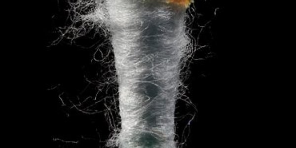 Everyone take a big sigh of relief: national guidelines for earwax removal have just been released