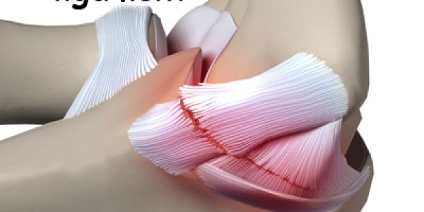 Baseball Pitchers Don't Win More Games Following Tommy John Surgery