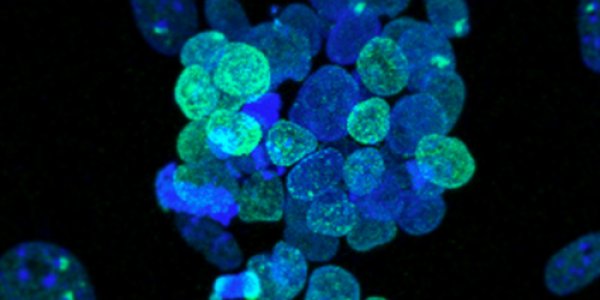 Induced Pluripotent Stem Cells Reset To Pristine State