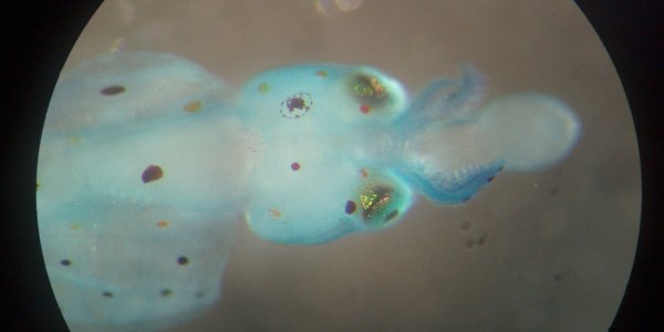 Stained Squid, Part II