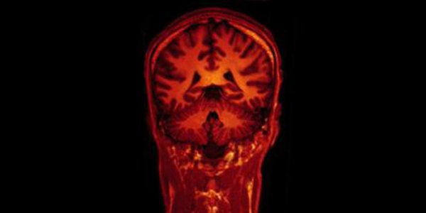 Will Brain Images And Thoughts Be Protected Under The 4th And 5th Amendments?