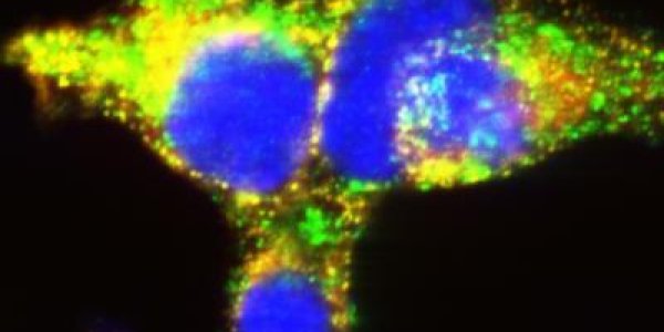 Insulin Pathway Map Could Lead To Better Diabetes Drugs