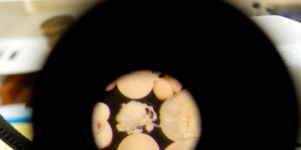 Tracking Marine Plankton Provides New Information To Reconstruct Past Climate