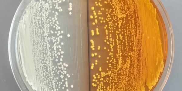 Turning Yeast Into Morphine At Home Could Be A Brewing Controversy