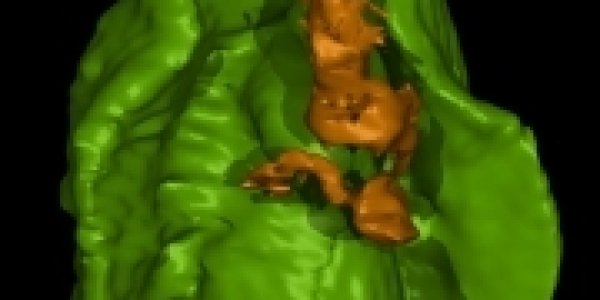 Drakozoon - The Blob From 400 Million Years Ago