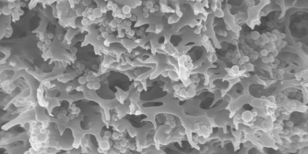 Binding Pollutants In Water Using Adsorber Particles