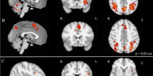 Had Musical Training? You Probably Have An Enhanced Brain