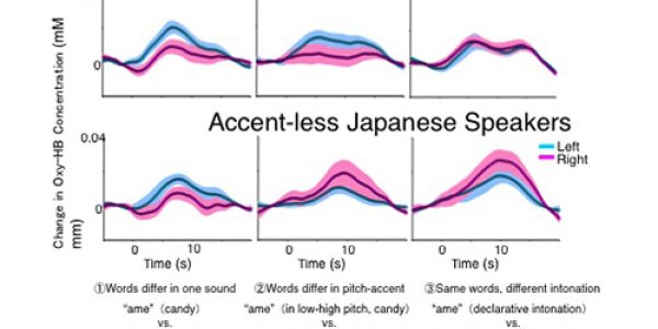 Brain Areas That Process Spoken Language Impacted By Learning Dialects