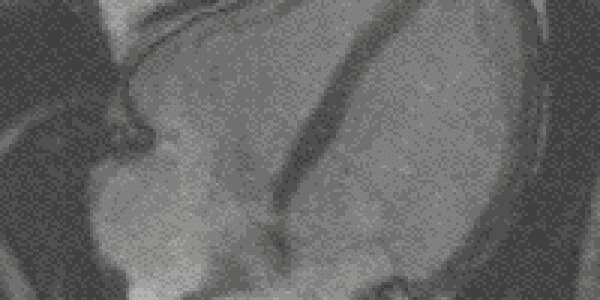 Discovered: Key Regulator Of Heart And Blood Vessel Development (And It Can Be Manipulated)