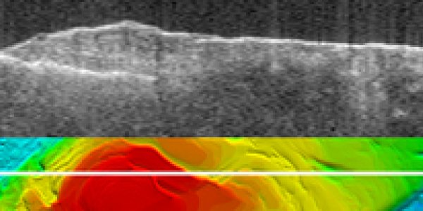 Mars Express radar gauges water quantity around Mars south pole