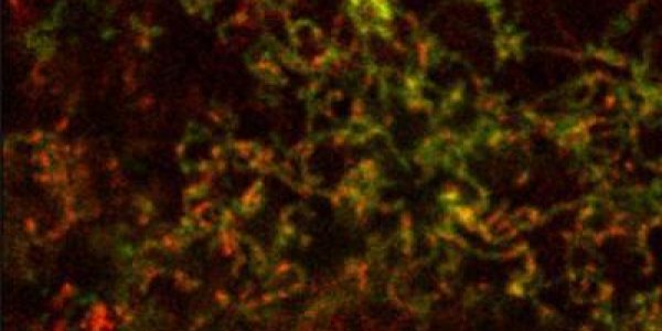 Function Found For Mysterious Heart Disease Gene