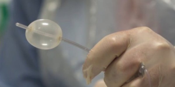 An Alimentary Voyage